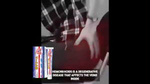 Hemorrhoid Cream Hemorrhoids Medicine 20g Hemorrhoids Treatment Pain Relief Clearing Heat And Detoxification Hemorrhoids Pain