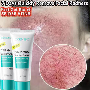 SADOER | Facial Redness Reduce Cream Improve Sensitive Skin Dryness Moisturizer Hydrating Sooth Lotion Rosacea Decrease Korean Cosmetics
