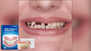 New Denture Silicone Kit Denture Silicone Liners Soft Denture Kit Soft Denture Kit Teeth Upper And Lower Set Easy Use
