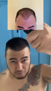 Hair Growth Ginger Shampoo 250ml Anti-Hair Loss Biotin Protect Scalp Natural Extracts Ketoconazole Hair Thickener