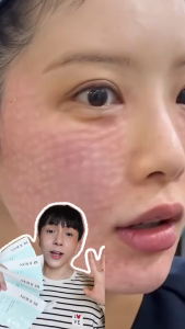 Mặt Nạ C-PDRN Dưỡng Ẩm Làm Dịu Da Rejuran PDRx 5% With C-PDRN Moisture Treatment Mask Hộp 5 Miếng Chính Hãng