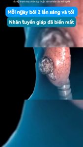 KEm cường giáp 50g Senjoko Tuyến Giáp Phân Tán Điều Hòa Tuyến Giáp Đặc Biệt Sưng Lớn Sử Dụng Bên Ngoài