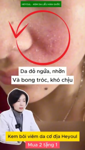 Kem heyoultổ đỉa Nấm da (nấm hắc lào nấm móng nấm chân) da cơ địa dị ứng sơn nails