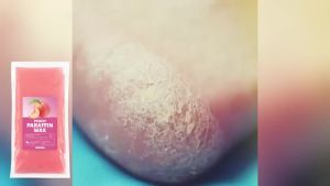 EELHOE | Peach Moisturizing Hand Wax Mask Exfoliating Nourishing Skin Hand and Feet Paraffin Spa Improve Dryness Smoothing Soft Skin Care