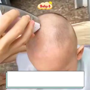 Tông đơ cắt tóc cho bé siêu êm khi bé ngủ tự động hút tóc tiện lợi Baby-S Máy cắt tóc cho bé chính hãng Mitsuta cao cấp kèm bộ phụ kiện - SDT004