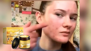 【Ready Stock】Hoygi Bee Venom Soothing Cream 60g – Nourishing Moisturizer for Dry & Irritated Skin Gentle Body Cream for Sensitive Skin Daily Skin Relief Balm