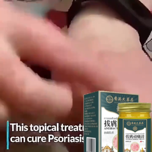 50g Eczema Treatment Cream Original Psoriasis Ointment Potent Treatment Eczema Itchy Skin and Allergy Anti Fungal Cream