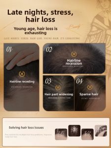RENHEJIANGXIN | Ginger Anti-Hair Loss Oil Control Dandruff Shampoo