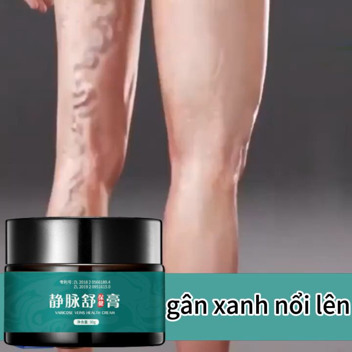 Cải thiện tĩnh mạch mạng nhện,Kem bôi giãn tĩnh mạch, kem làm dịu tĩnh ...
