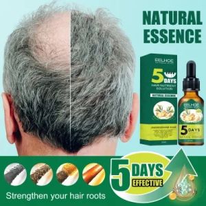 EELHOE Hair Growth Serum Penumbuh Rambut Wanita Pria Secara Cepat - Clothes of Skin 7 Days Ginger Germinal Oil 30ml - Serum Rambut Rontok / Obat Penumbuh Rambut Botak Mirip Red Ginseng Hair Tonic Minyak Kemiri