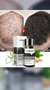 Lanbena Hair Growth Essential Oil Penumbuh Rambut Botak dan Rontok