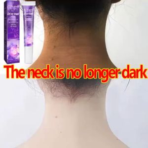 [SG SELLER]Body Whitening Cream for Private Dark Spot Remover Brightening Cream Body Lotion Women Moisturizing Firming & Skin Repair For Dark Skin Underarm Private Part EELHOE去黑嫩红素