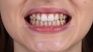 7D White Hydroxyapatite Tooth Powder 20% NHAP Ice Double Mint Whiten Teeth Fresh Breath Oral Care With Natural Ingredients 60g
