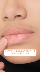 LIP POTION COLD FIRE / MELEMBABKAN BIBIR / MERAWAT BIBIR / MENGATASI BIBIR KERING