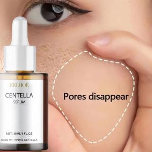 EELHOE | Centella Asiatica Shrink Pores Face Serum Fade Facial Redness Blood Cream  Moisturizing Brightening  Korea Skincare Product