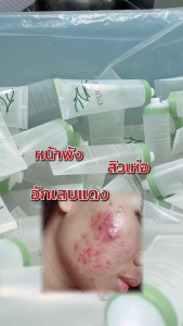 อโลเวร่า - eve(s) ALOE VERA HYDRATING & TREATMENT GEL