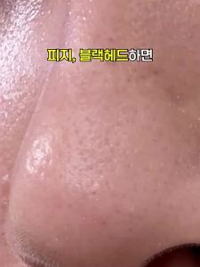 Blackhead Removing Deep Cleansing Toner 150ml