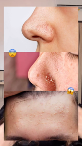 [SALE] Cleora 30 Seconds Natural Eksfoliasi Peeling Gel - Membantu Mengangkat Sel kulit Mati Sisa Kotoran & Kusam Skincare Scrub Facewash Peel Exfoliasi Wajah Jerawat Acne Kosmetik Brightening Whitening Dark Spot Mencerahkan Muka Sensitif Wanita Pria