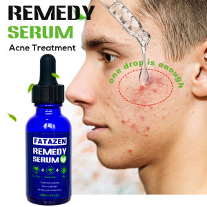 Natural Organic Remedy Serum Acne Treatment Facial Serum For Oily Skincare Green Tea Vitamin C Serum
