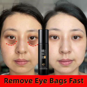 eye serum oil eyebag dark circle anti aging wrinkle anti aging serum roller eye bag remover eye care mata night repair panda eyes moisturizer mata panda lifting firming fade fine lines 眼部精华油10ml