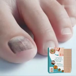 Nail repair patch onychomycosis soft nail ingrown toenail thickening soft nail treatment anti-infection correction patch ingrown toenail care