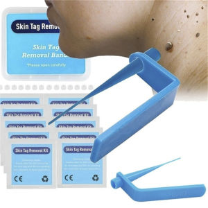 Simple Skin Care Kit: Warts Remover & Skin Tag Removal Tools