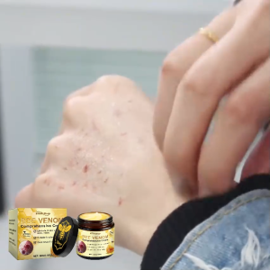 【BUY 1 TAKE 1】South Moon Bee Venom Comprehensive Cream For Psoriasis Eliminate Tags Warts Moles Body Cream Repair Damage Skin Strengthens Skin Barrier Gently Cleans Skin Smoothing Hydrating Multi-Purpose 60g