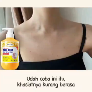 Permanent Acne Removal Sulfur Anti-mite Shower Gel 500ml Antibacterial Acne-Clearing Moisturizing Gel mandian penyingkiran hama sulfur 祛痘除螨沐浴露抗菌沐浴露500ML