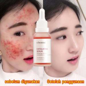 penghilang jerawat serum wajah AHA ORI 30ML penghilang komedo Exfoliating penghilang bekas jerawat kulit menghalus dan Mencerah
