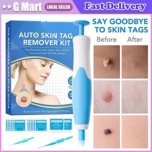 2 IN 1 Auto Skin Tag Remover Kit: Micro Skin Tag Removal Device & Adult Mole Stain Wart Remover