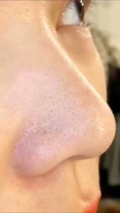 Mặt Nạ Lột Mụn Than Tre Kniyea 60g – Làm Sạch Mụn Cám Đầu Đen Se Lỗ Chân Lông Dưỡng Da Mịn Màng