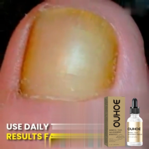 Ouhoe Nail Repair Essence Antibacterial Remove Onychomycosis Anti Infection Paronychia Nourishing Brighten Nail Toe 30ml