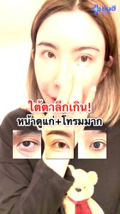 Yanhee Recovery Eye Serum ยันฮี รีโคฟเวอรี่ อาย เซรั่ม ลดถุงใต้ตาบวมห้อย ริ้วรอย ตีนกา ใต้ตำดำ eye