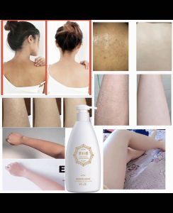Exfoliate body lotion Ultra hydrating body lotion 500ml moisturizing Brighten Exfoliate the body hands legs Remove dry skin melanin fish scale skin
