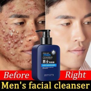 【Malaysia Stock&COD】Mens Special Oil Control Moisturizing Refreshing Cleansing Pore Cleanser 160g Men Total Anti Acne Foam Amino Acid Facial Cleanser Whitening Brightening