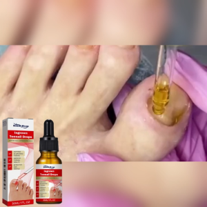 【BUY 1 TAKE 1】South Moon Ingrown Toenail Drops Anti Inflammatory Ingrown Toenail Pain Reliever Foot Toe Nail Fungus Removal Drops Foot Care 30ml