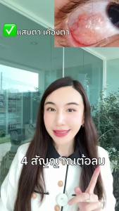 อาโมนิลูทีน Armoni Lutein อาโมนิซิงค์ Armoni Zinc วิตามิน ลูทีน ซิงชั่น วิตามิน บำรุงดวงตา วิตามินชายนิ่ง