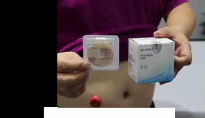 VÒNG CHỐNG LOÉT HẬU MÔN NHÂN TẠO