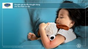 Kem làm dịu và phục hồi cho da chàm viêm da cơ địa CETAPHIL PRO AD DERMA REPAIR CREAM 227g