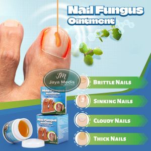 Cream Perawatan Kuku Original - Nail Fungus