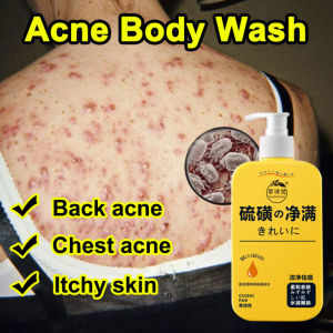 Sulfur Acne Body Wash Back Acne body Wash 300ml Deep Clean Whitening and Moisturizing for Body Anti-Mite and Anti-Itch Repair Back Acne Brighten Skin