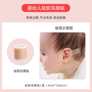 Ear Brace Baby Newborn Orthosis Wind Ear Baby Hair-Styling Equipment Lop-Ear Correction Stickers Auricle
