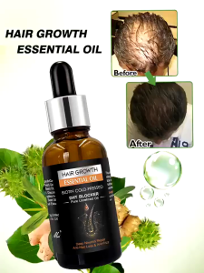 Tinh Dầu Mọc Tóc Biotin DHT Blocker – Ngăn Rụng Kích Thích Mọc Tóc Giảm Gàu Giúp Tóc Dày Khỏe