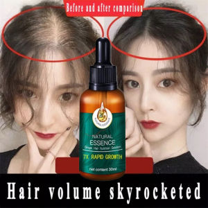 EELHOE Hair Growth Serum PENUMBUH RAMBUT Cairan Serum Penumbuh Rambut Anti Rontok /Obat Rambut Botak / Serum Penumbuh Rambut Botak / Penumbuh Rambut Botak / Obat Penumbuh Rambut Botak Pria / Rambut Rontok Parah / Rambut Rontok Penyubur 30Ml