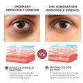 IUALLURE Eye Essence OilEye Cream for Dark Circles eye bag remover eye care Anti Aging Remove Fine Lines Fat Particles  Fade Dark Circles Fine Lines Lift Anti-Wrinkle  眼霜Firming Remove Eye Bags Men Women. 