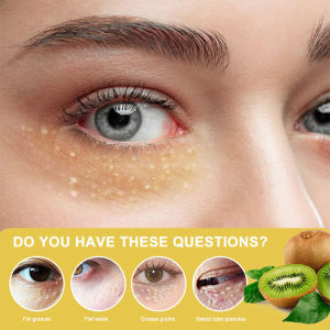 milia seed remover vitamin e eye cream syringoma milia remover grease grains clearing 油 粒 脂肪粒