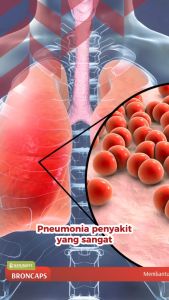 Broncaps Obat Herbal Naturafit Meredakan batuk sesak nafas dan Membersihkan Paru-paru 60 Kapsul