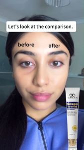 Krim Mata Anti Keriput Eye Serum Anti Aging Kerut Lingkaran Hitam Kantung Mata Di Area Mata untuk Mencerahkan dan Mengencang Area Mata