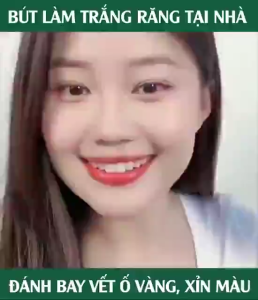 Bút Tẩy Trắng Răng Dazzling White USA – Răng Trắng Sáng Tự Nhiên Xóa Ố Vàng Không Ê Buốt Hiệu Quả