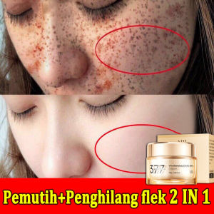 377 Krim Bintik Niacinamide Penghilang Flek Hitam Cream 30g Penghilang Bintik Bintik Gelap Perawatan Kulit Pelembab Wajah